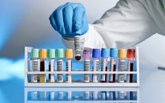 Антитела к глутаматдекарбоксилазе